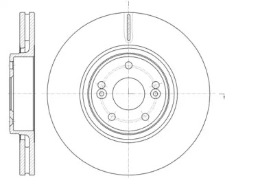 REMSA 61171.10