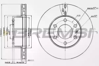 BREMSI DB0314V