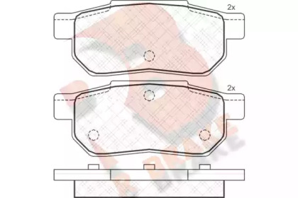 R BRAKE RB1045