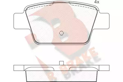 R BRAKE RB1503