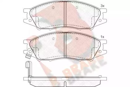 R BRAKE RB1635