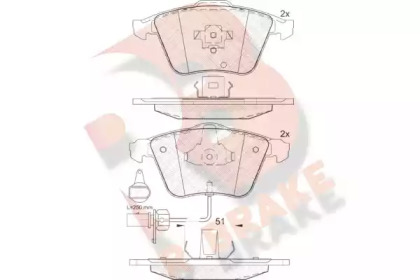 R BRAKE RB1654