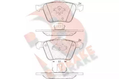 R BRAKE RB1655