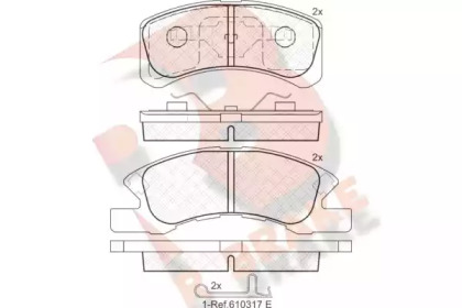 R BRAKE RB1701